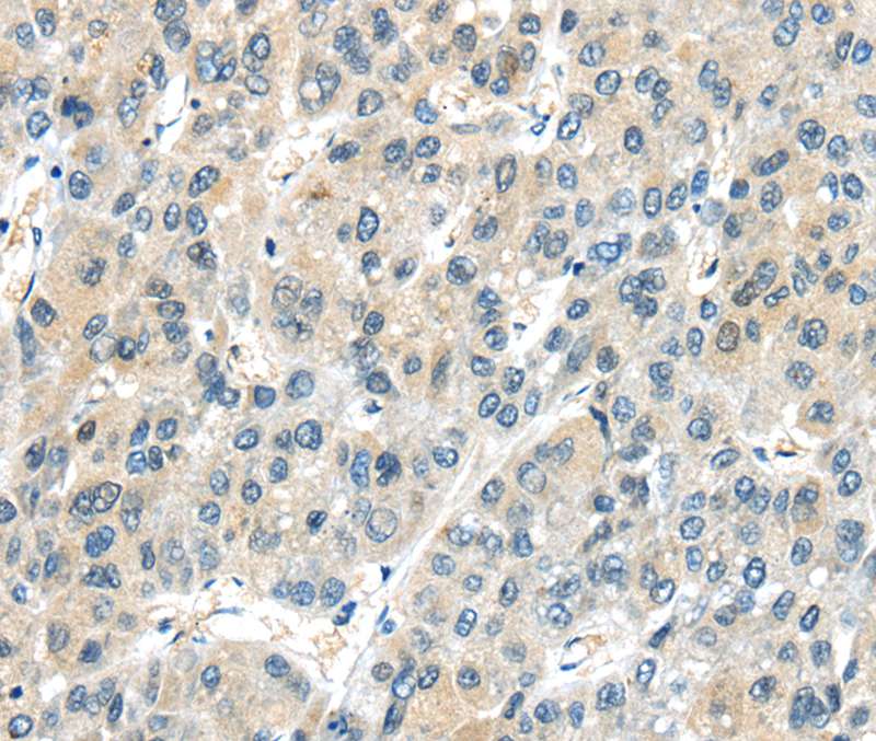 AHI1 Antibody