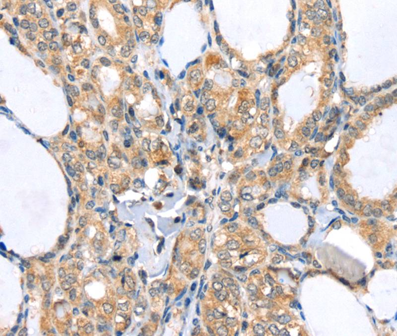 LLGL2 Antibody
