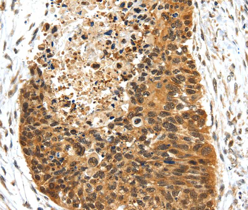 NR2F2 Antibody