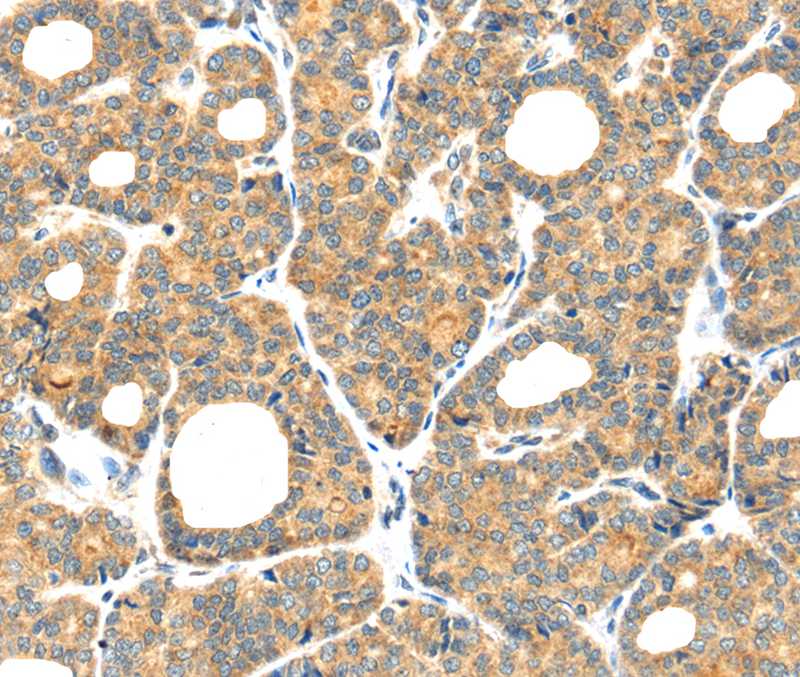 PLAGL2 Antibody