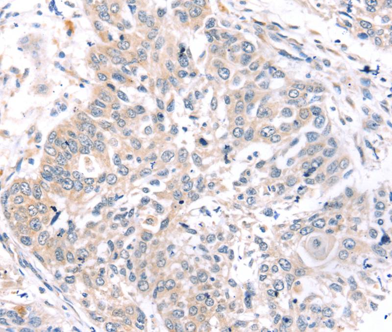 ROR1 Antibody