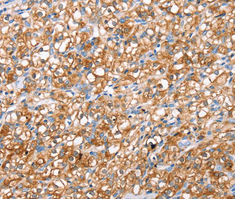 ABCC8 Antibody