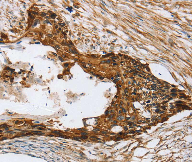 TPD52L2 Antibody