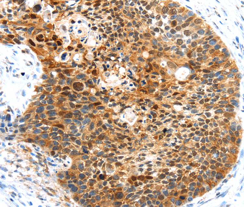 HUNK Antibody