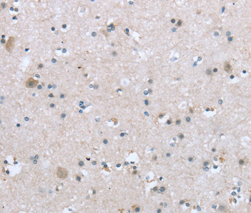 TRPM3 Antibody