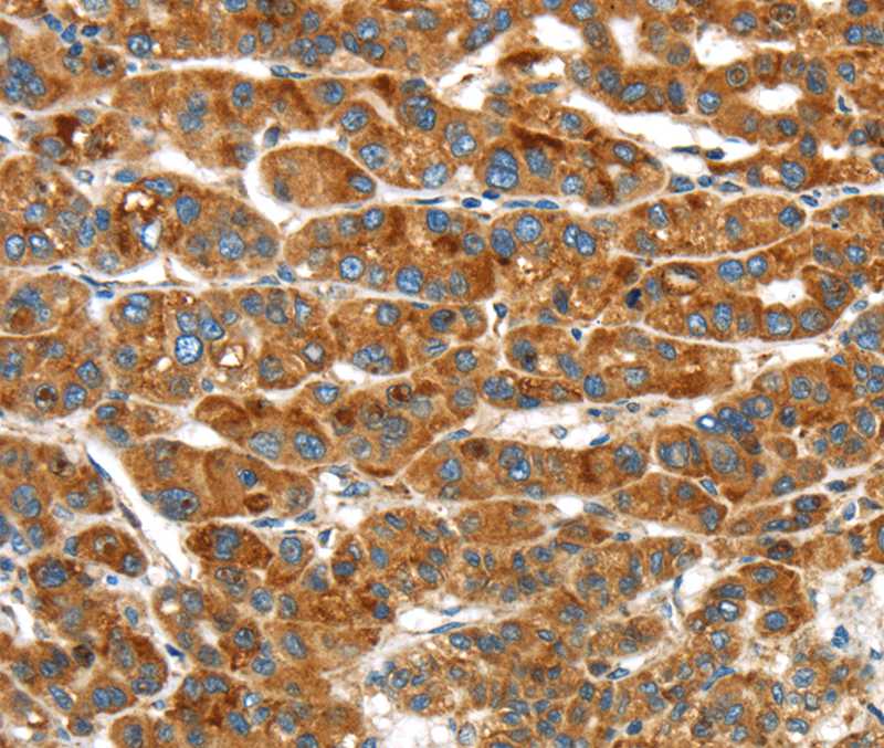 ERP44 Antibody