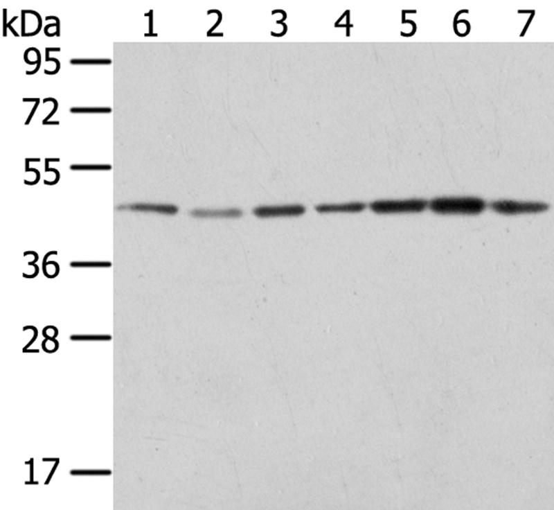 ERP44 Antibody