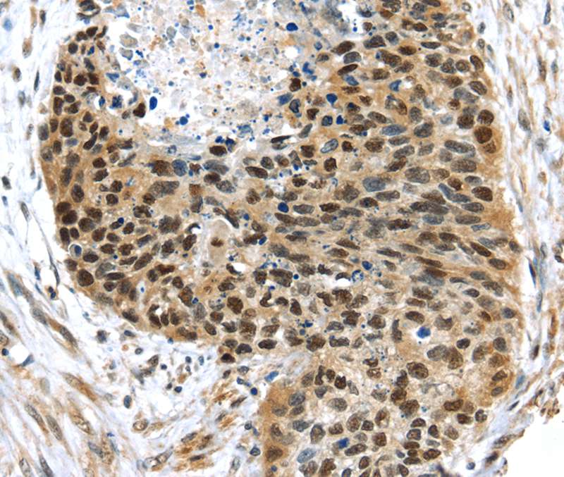 UBA1 Antibody