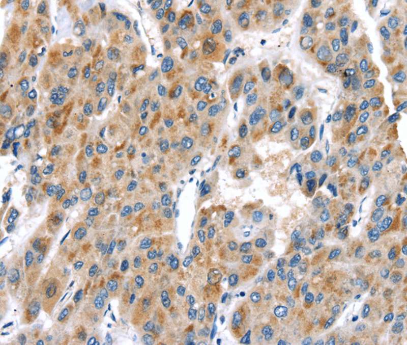 UCP2 Antibody