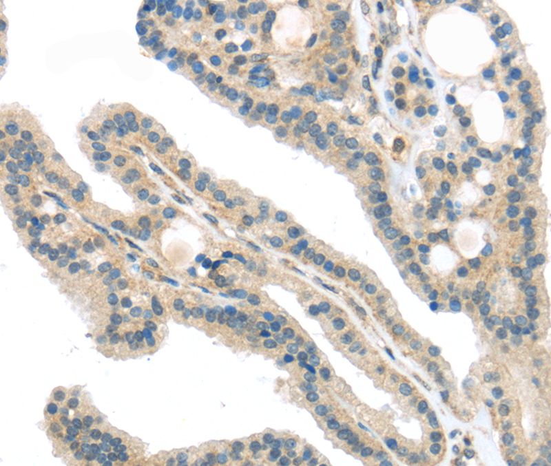 VPS26A Antibody