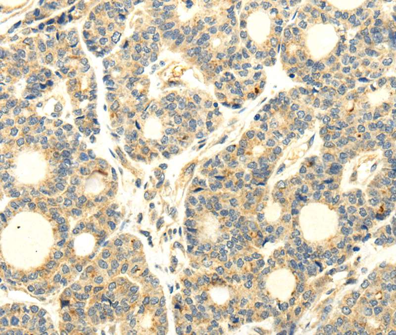 WDR91 Antibody