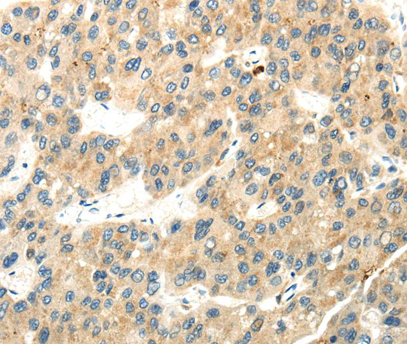 WDR36 Antibody