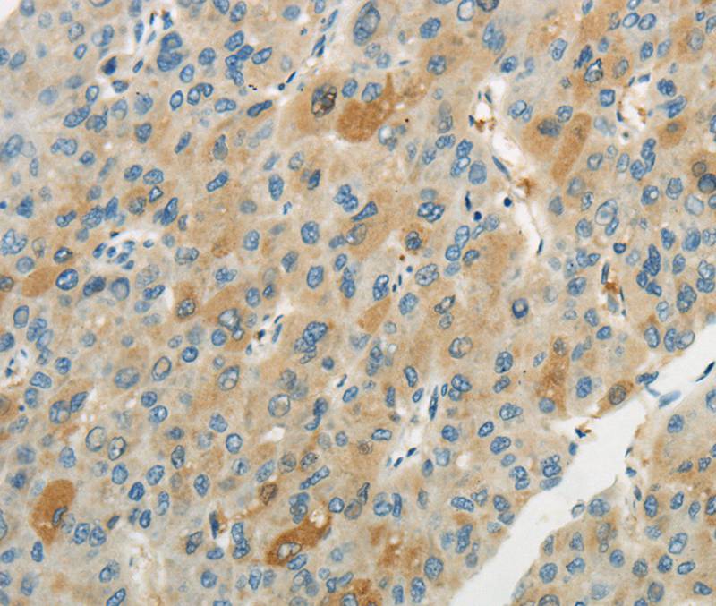 WNT2B Antibody