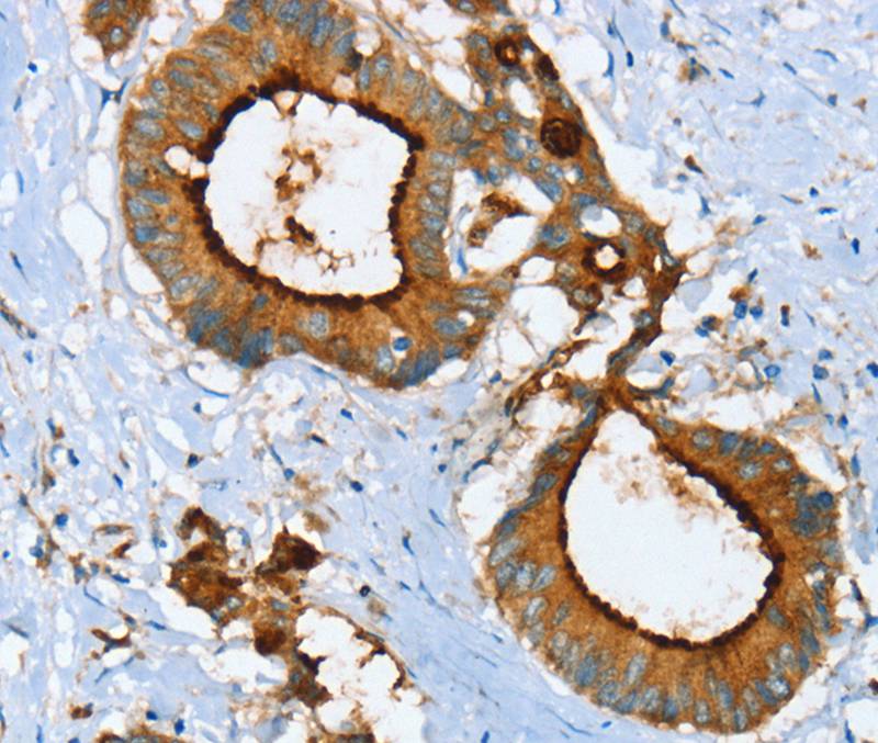 LGALS3BP Antibody