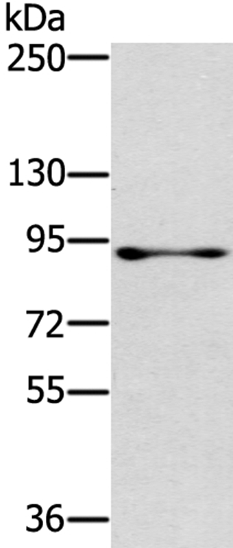 RASAL1 Antibody