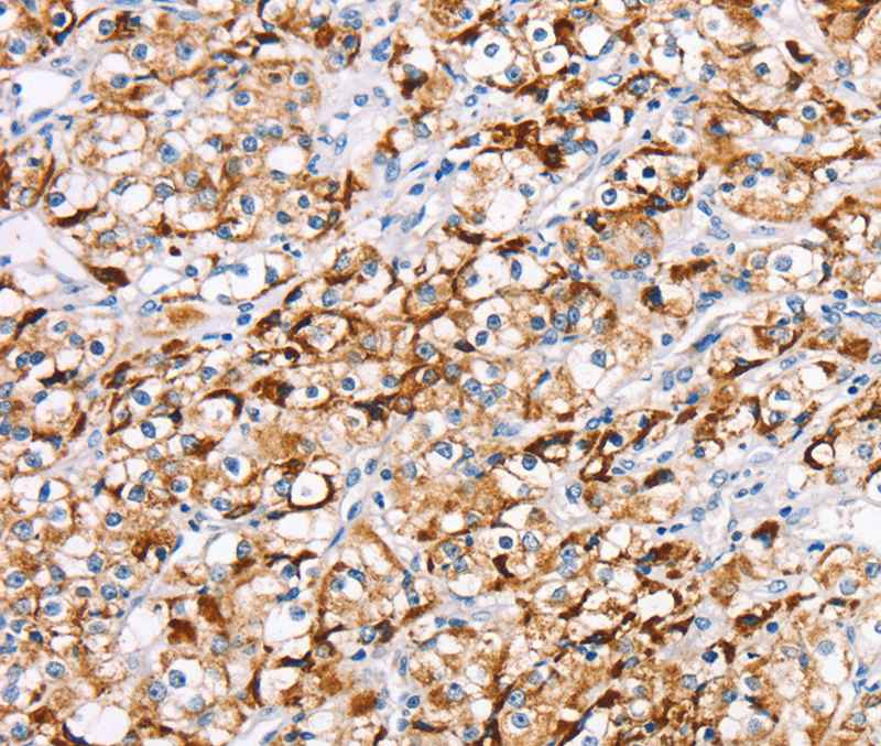 RDH11 Antibody
