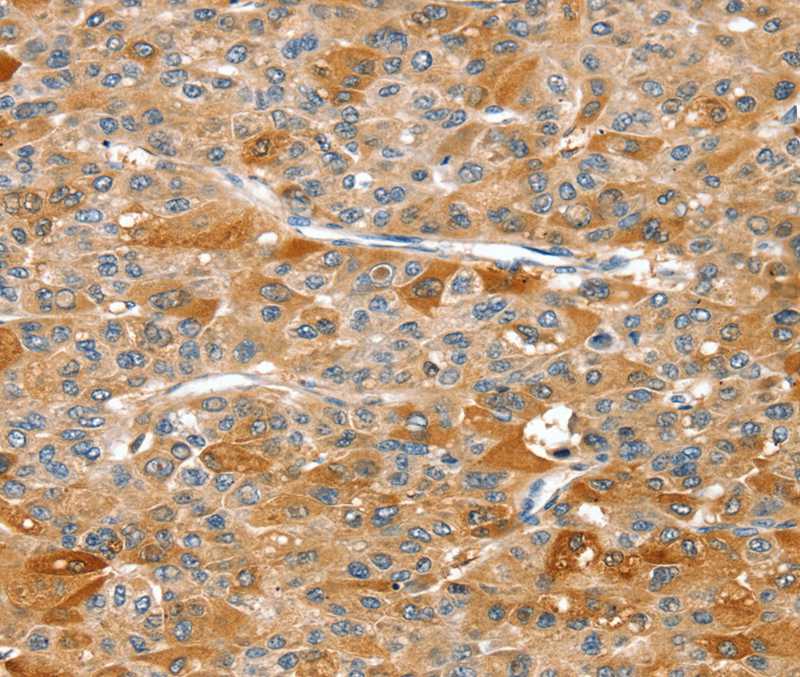 DSTYK Antibody