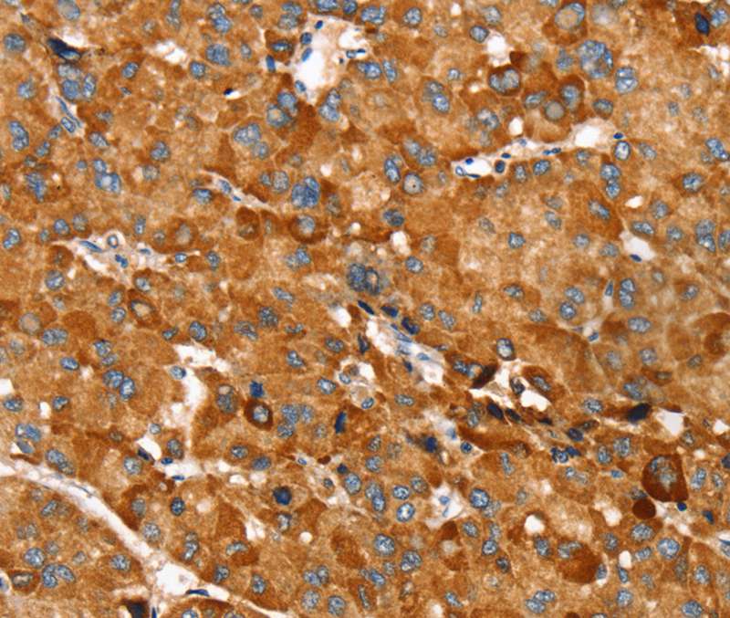 RNF14 Antibody