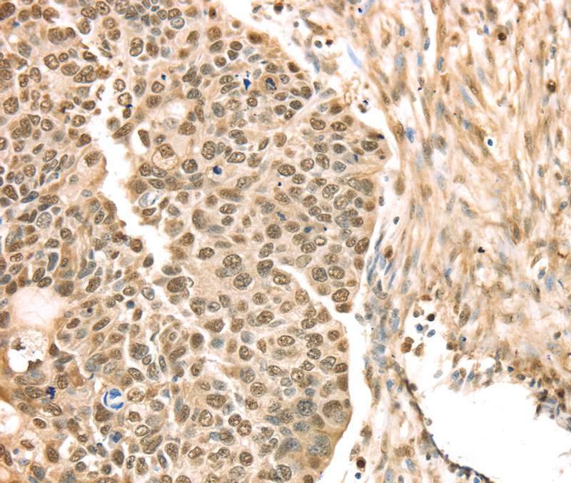 SAMD3 Antibody