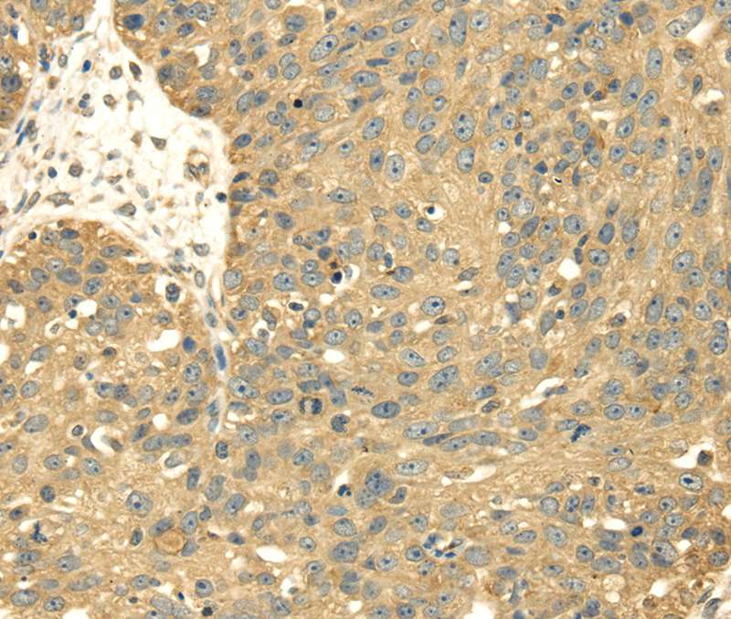SRPRB Antibody