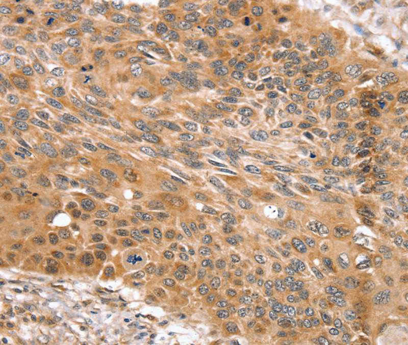 SNX11 Antibody