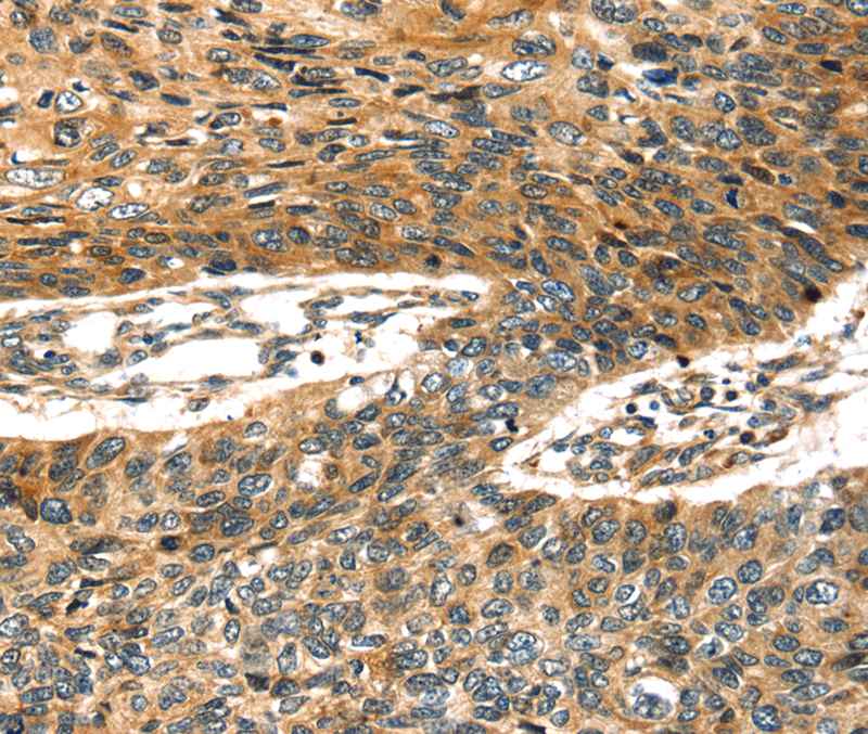 STX19 Antibody