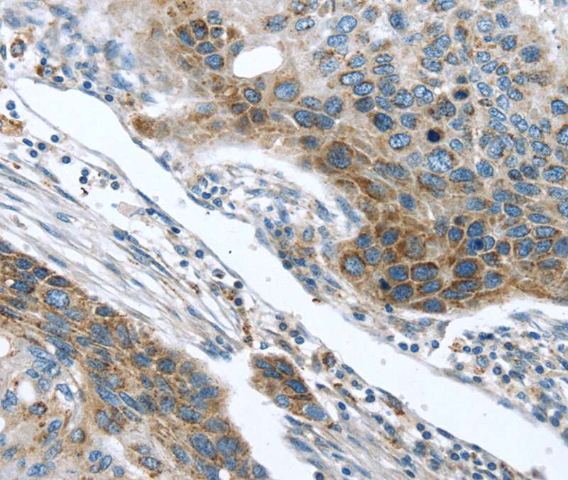 TMPRSS5 Antibody