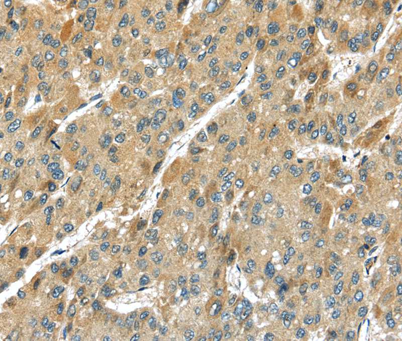 TMPRSS11D Antibody