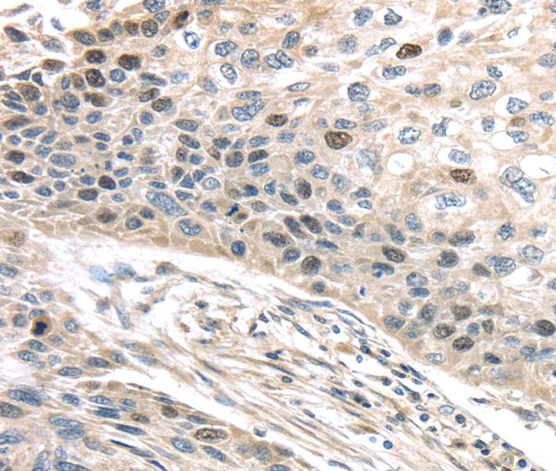 TPX2 Antibody