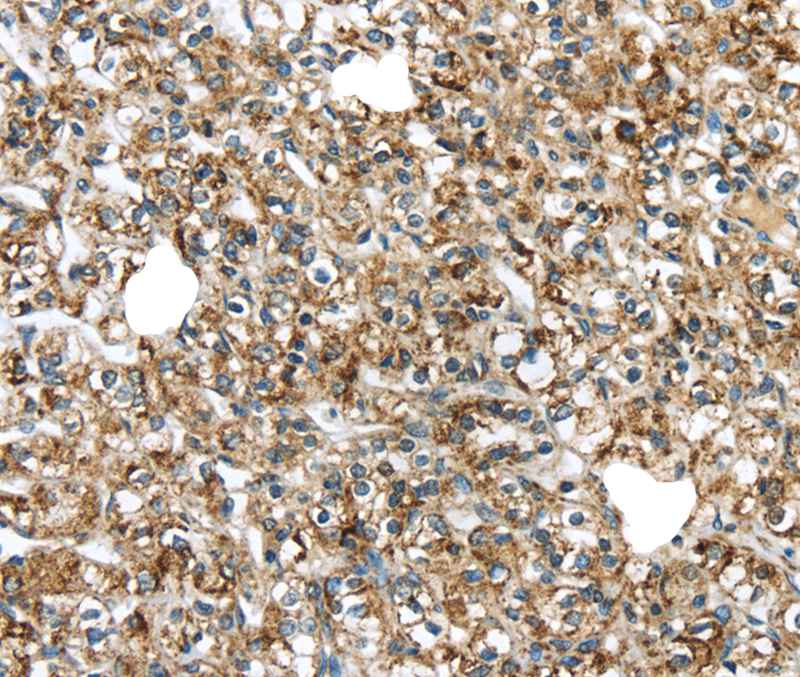 TGM4 Antibody