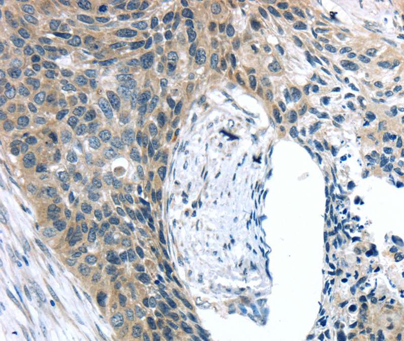 KIT Antibody