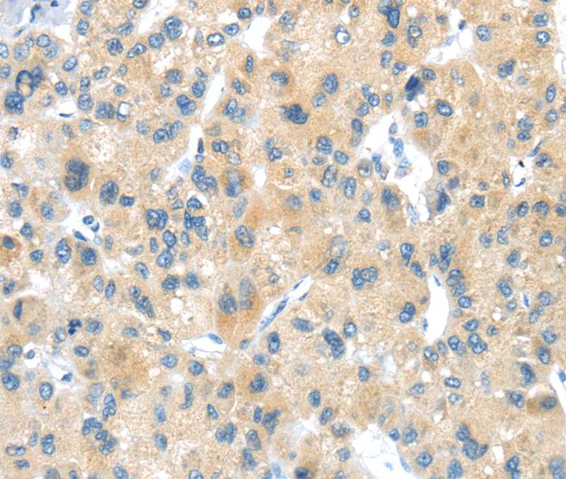 LPAR1 Antibody