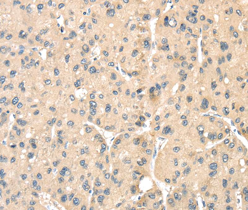 LOXL3 Antibody