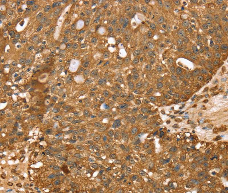 STARD5 Antibody