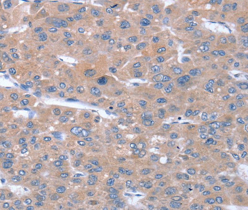 SULF1 Antibody