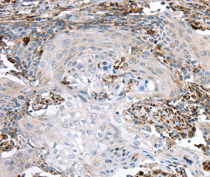 TBXA2R Antibody