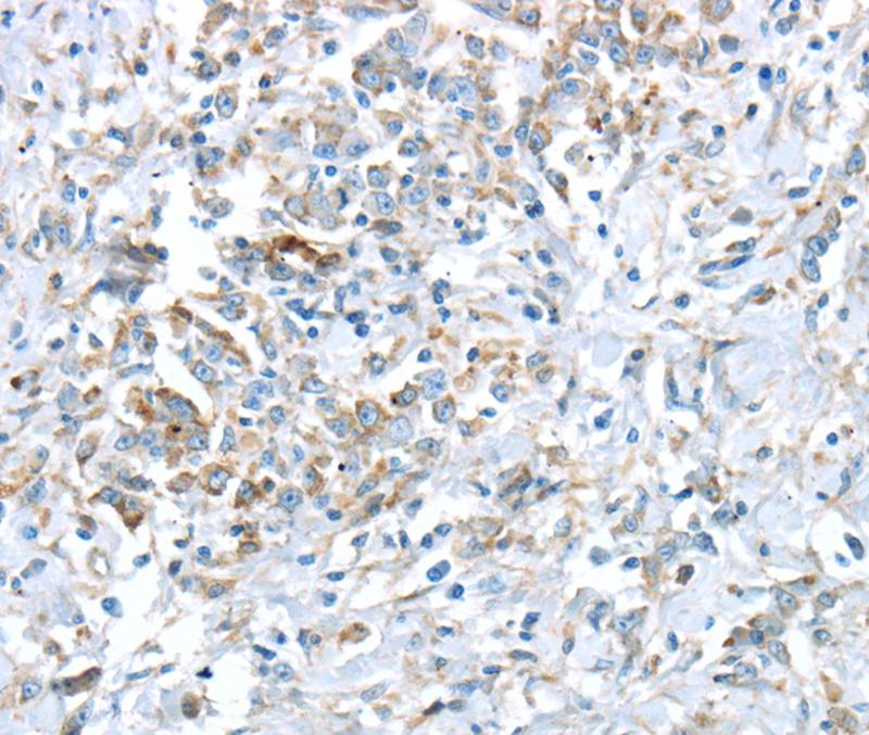 VWCE Antibody