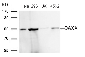 DAXX (Ab-739) Antibody