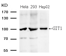 GIT1 (Ab-383) Antibody