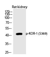 KOR-1 (Phospho-Ser369) Polyclonal Antibody