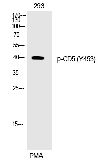 CD5 (Phospho-Tyr453) Polyclonal Antibody