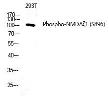 NMDAζ1 (Phospho-Ser896) Polyclonal Antibody
