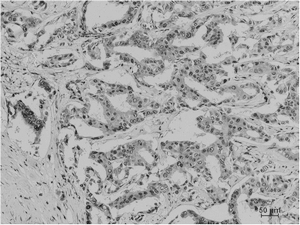 Acetyl Lysine Monoclonal Antibody