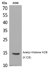 Histone H2B (Acetyl-Lys126) Polyclonal Antibody