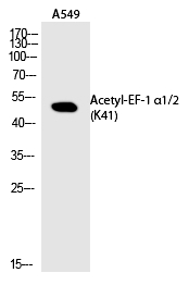 EF-1 α1/2 (Acetyl-Lys41) Polyclonal Antibody