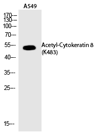 Cytokeratin 8 (Acetyl-Lys483) Polyclonal Antibody