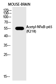 NFκB-p65 (Acetyl-Lys218) Polyclonal Antibody