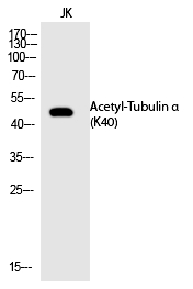 Tubulin α (Acetyl-Lys40) Polyclonal Antibody