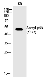 p53 (Acetyl-Lys373) Polyclonal Antibody