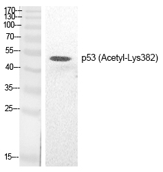 p53 (Acetyl-Lys382) Polyclonal Antibody